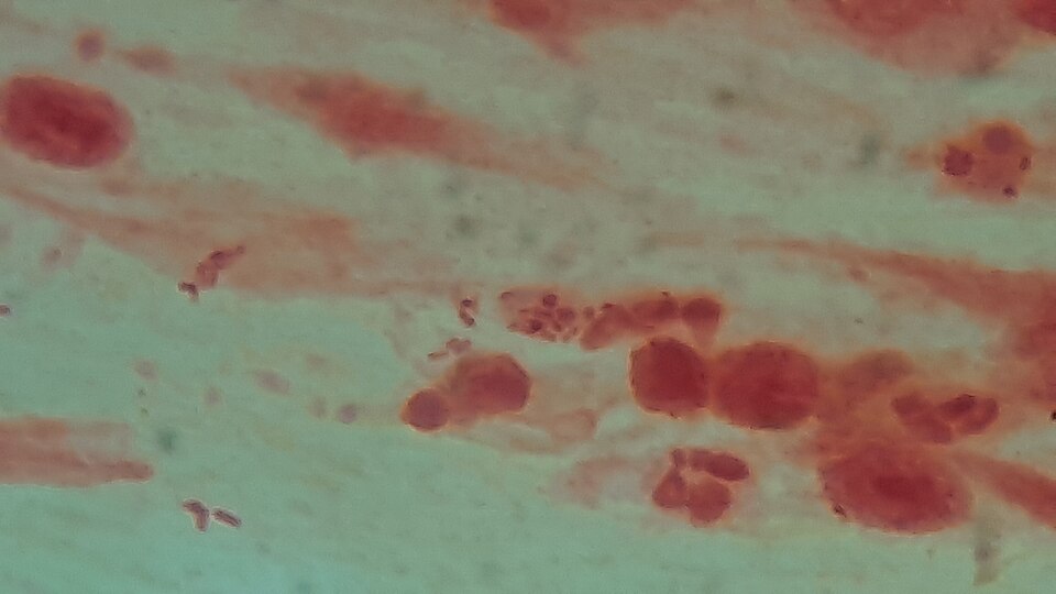 gram staining bacteria**