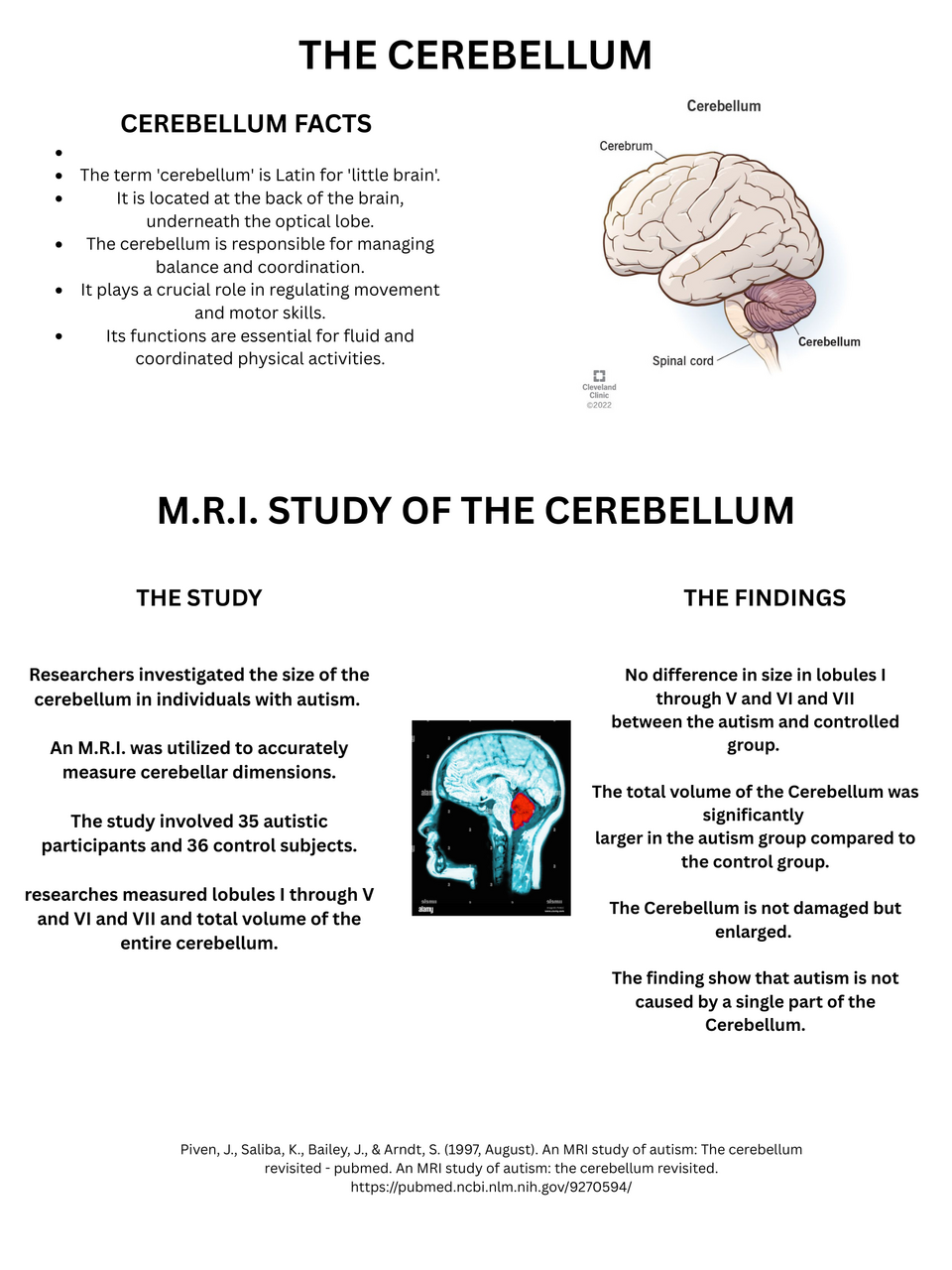 cerebellum labelled diagram