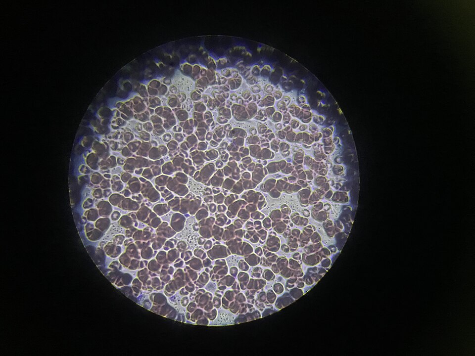 blood smear under microscope**