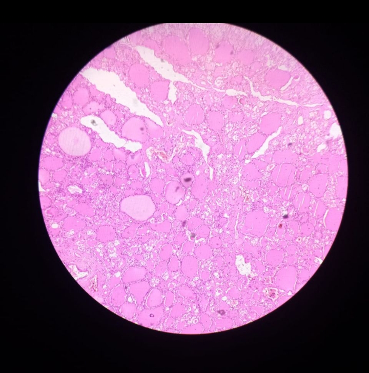 thyroid gland histology