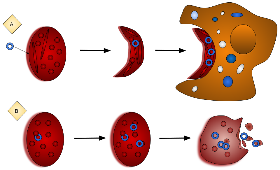 sickle cell anemia red blood cells