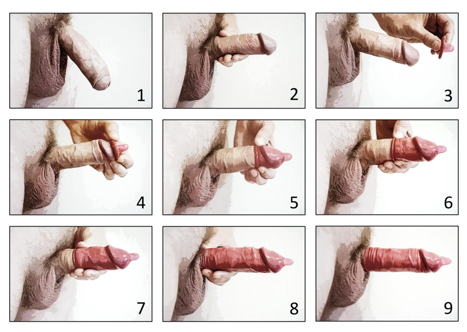 condom usage diagram**